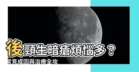 後頸生暗瘡|全方位暗瘡處理法：背暗瘡、太陽穴暗瘡、眉心暗瘡、。